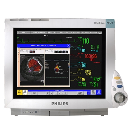 Monitor Multiparametro MP70